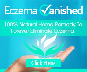 Eczema Vanished